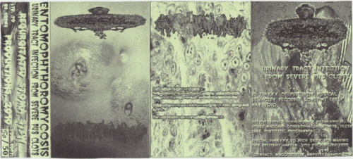 Urinary Tract Infection From Severe Pus Clots : Entomophthoromycosis - Urinary Tract Infection from Severe Pus Clots Urinary Tract Infection From Severe Pus Clots : Entomophthoromycosis - Urinary Tract Infection from Severe Pus Clots